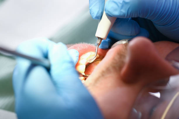 Best Mobile Emergency Dentist in New Castle, DE